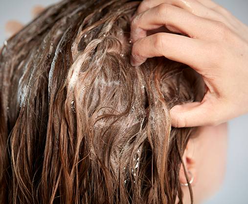 Dry Itchy Scalp
